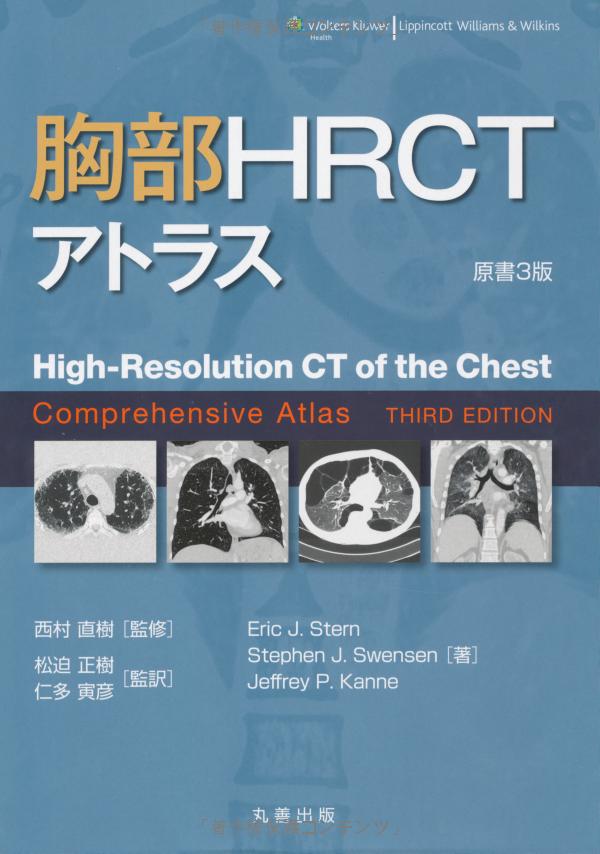胸部 hrct アトラス - high-resolution ct of the chest comprehensive atlas - Ảnh 2